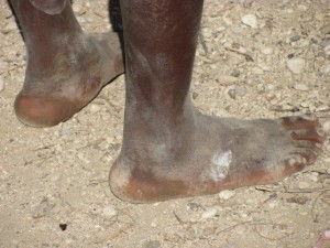 shoeless in haiti